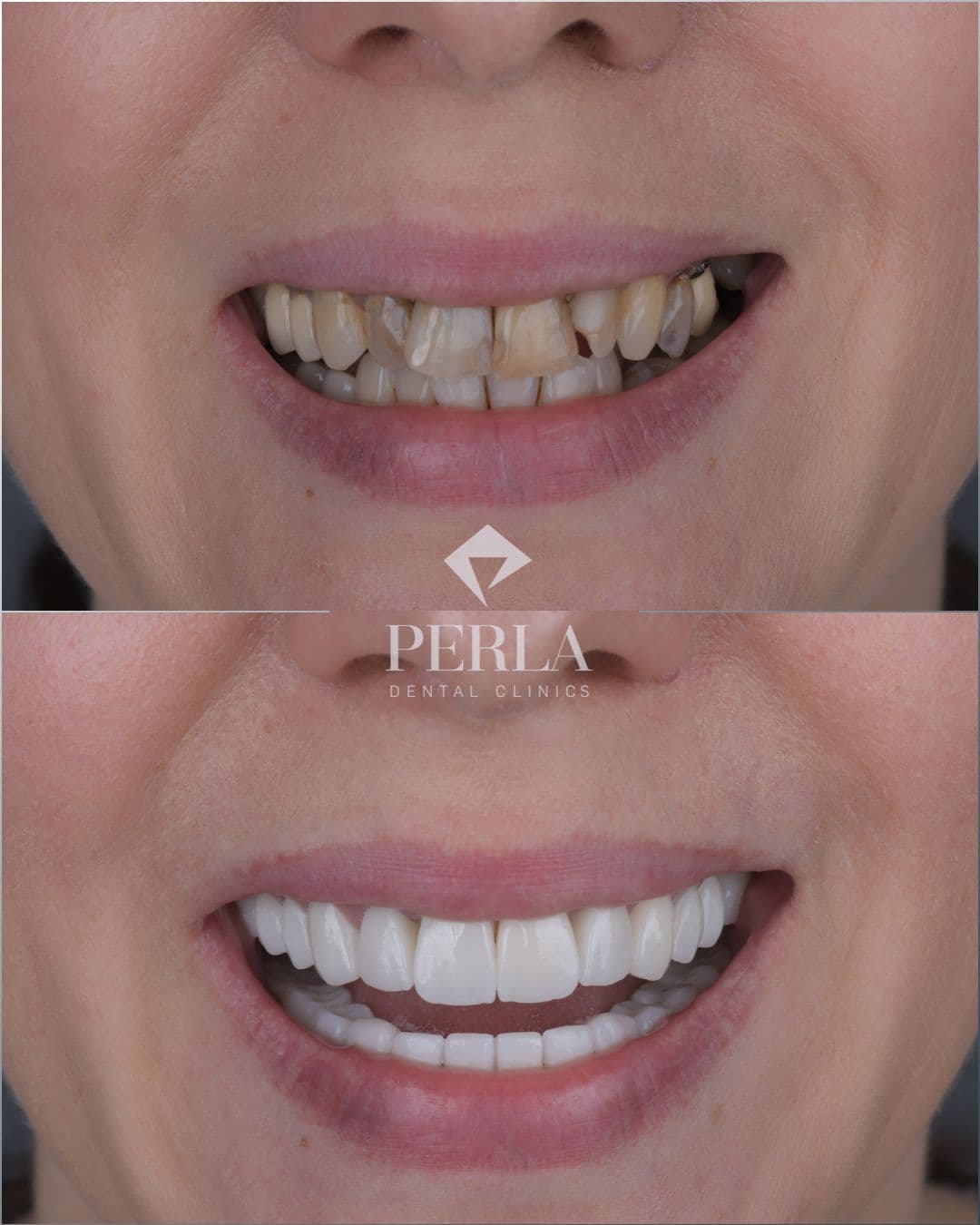 Dental treatment result 2