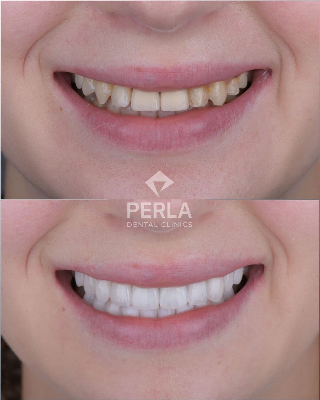 Dental treatment result 3