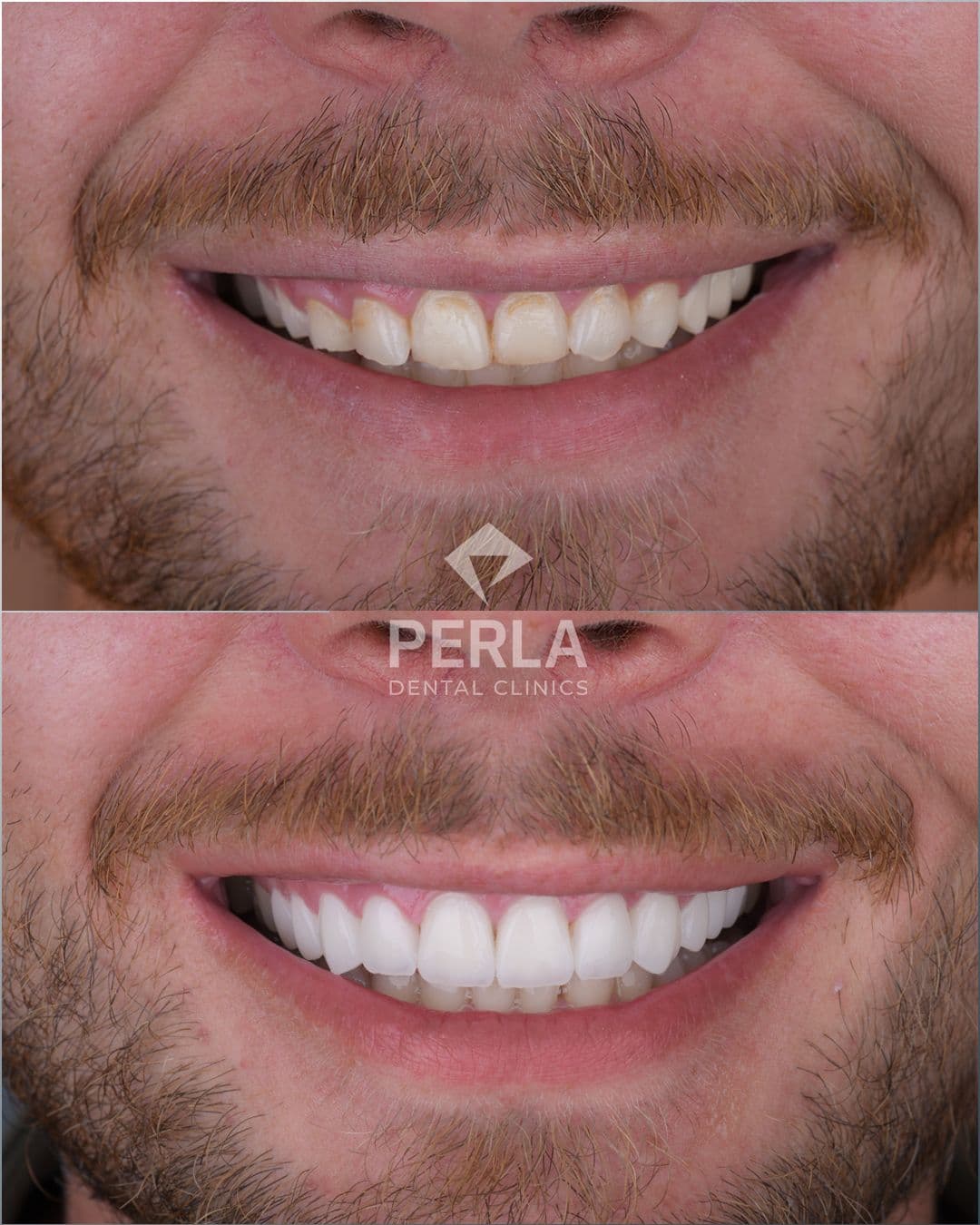 Dental treatment result 5